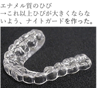 �i�C�g�K�[�h"